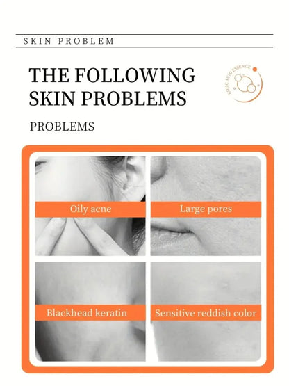 100g Kojic Acid Soap Glutathione Hand Soap Papaya Bath Soap Face Cleanser Makeup Remover